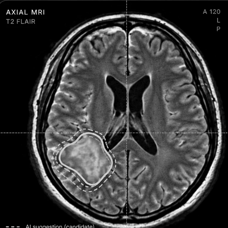 Illustrative grayscale anatomical image